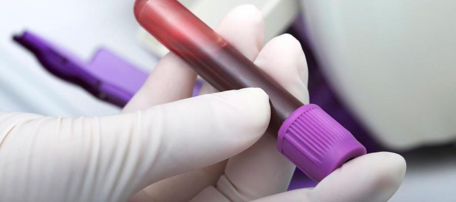 Freenome blood sample tech